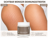 Jade Beauty Stretch Mark Cream – Anti-Dehnungsstreifen Creme (100 ml)